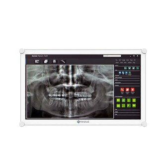 Neovo DR2202 22&quot; Dental monitor, FHD 1920x1080, 500cd/m2, 20.000:1, 3ms (GTG)